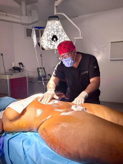 Aesthetic surgeon in the operating theatre in Tunisia, preparing a body contouring procedure