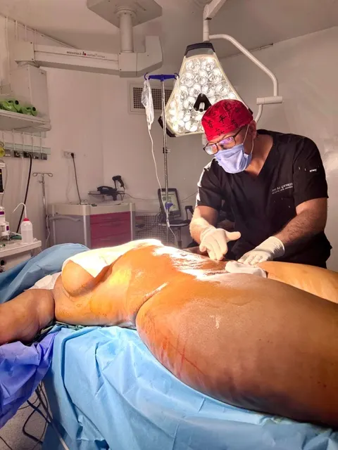 Aesthetic surgery photo shoot in the operating theatre, close-up of the surgeon at work
